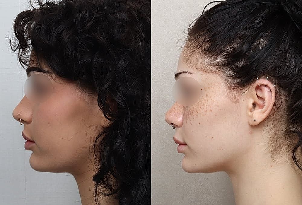 Side profiles of two young women.