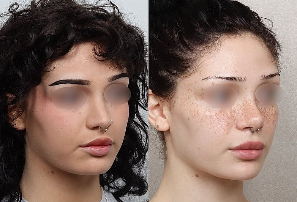 Before and after makeup transformation comparison.