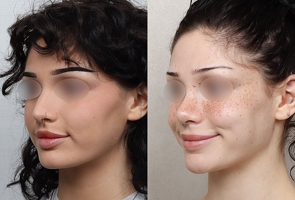 Two side-by-side portraits of a woman.