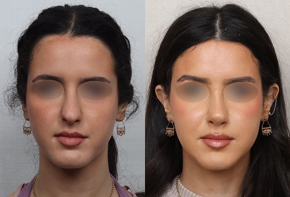 Before and after beauty transformation comparison.