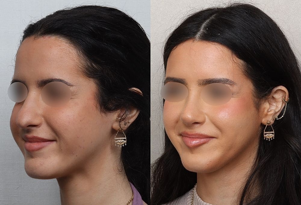 Side-by-side portraits of a woman smiling.