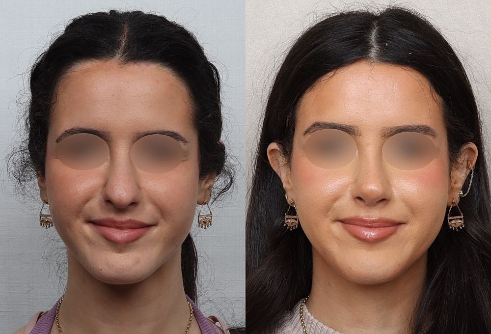 Before and after beauty transformation comparison.