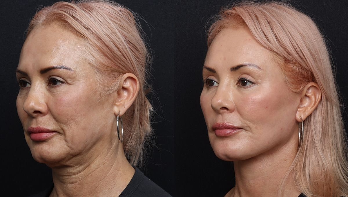 Profile view of woman with pink hair.